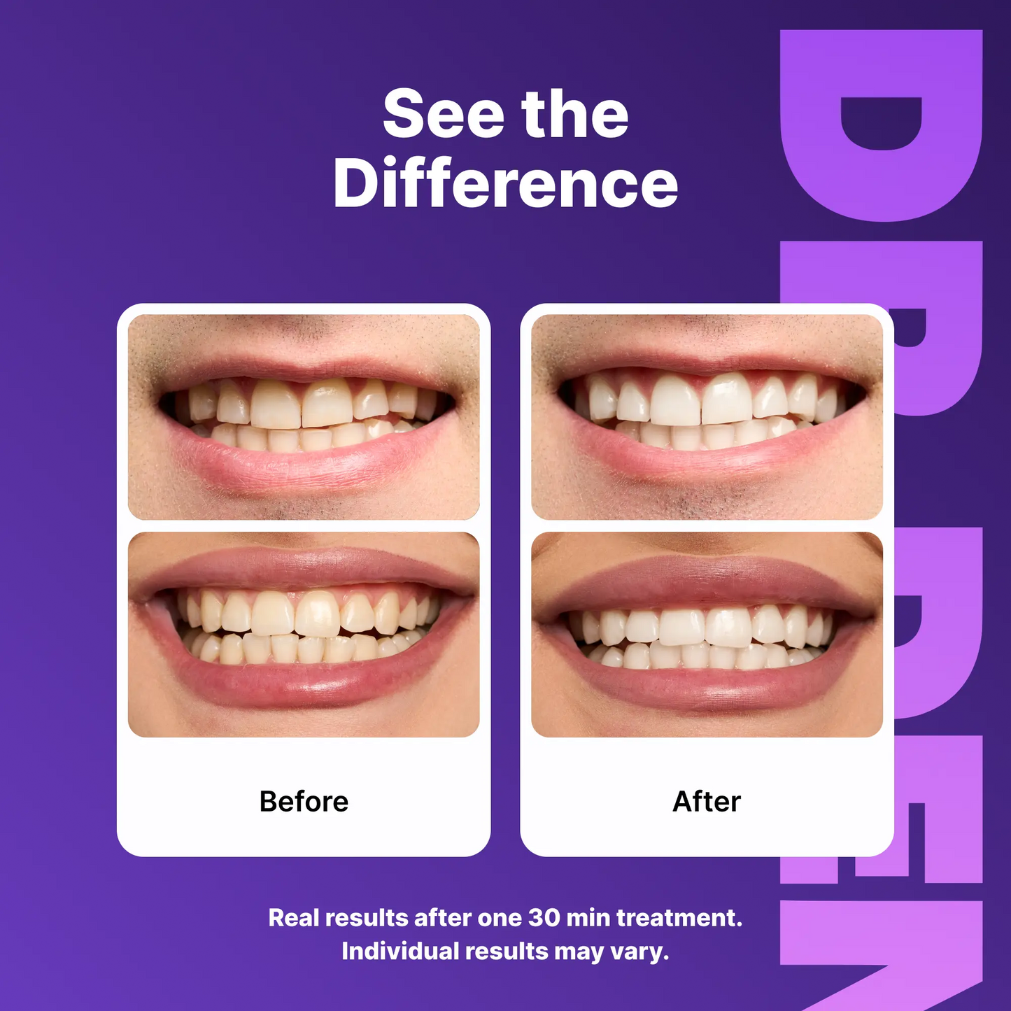 ClearLux Whitening Strips