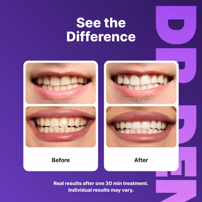 ClearLux Whitening Strips